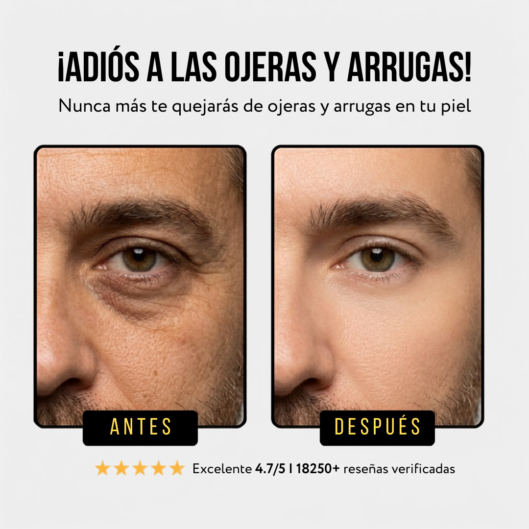 Noreva® Bálsamo de res rejuvenecedor para ojeras